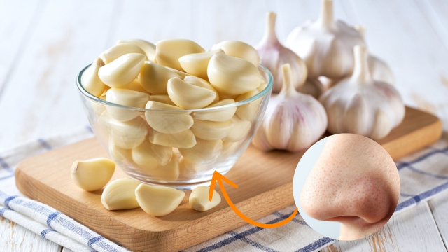 Que trend maluca é essa de alho no nariz? Entenda os perigos dessa nova tendência