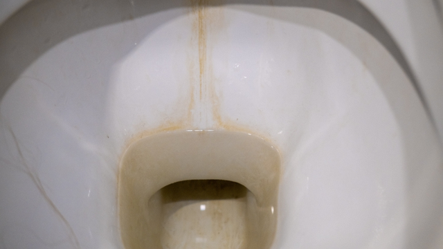 Nem sal, nem bicarbonato de sódio: essa é a melhor mistura caseira para remover o calcário do vaso sanitário e deixá-lo mais branco do que nunca