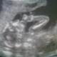Avatar de Lilian Brum